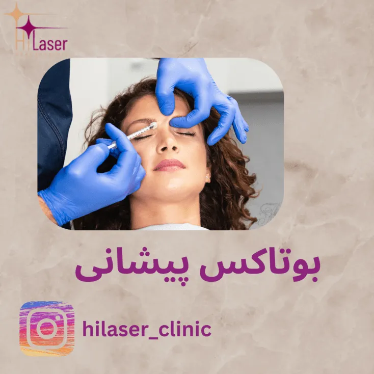 بوتاکس پیشانی