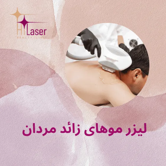 لیزر مو های زائد مردان