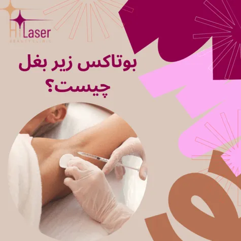 بوتاکس زیر بغل