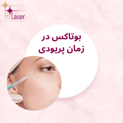 بوتاکس در زمان پریودی