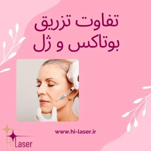 تفاوت تزریق بوتاکس و ژل