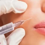 تفاوت تزریق بوتاکس و ژل