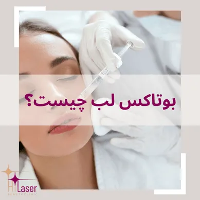 بوتاکس لب