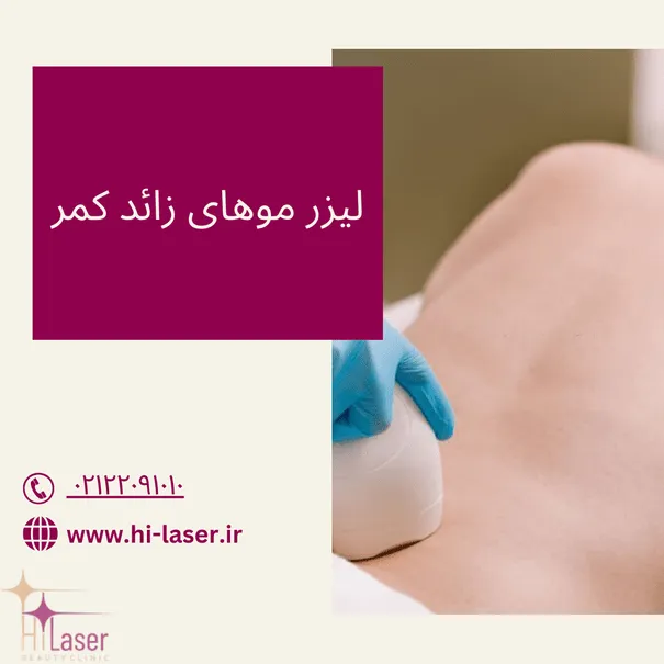 لیزر موهای زائد کمر