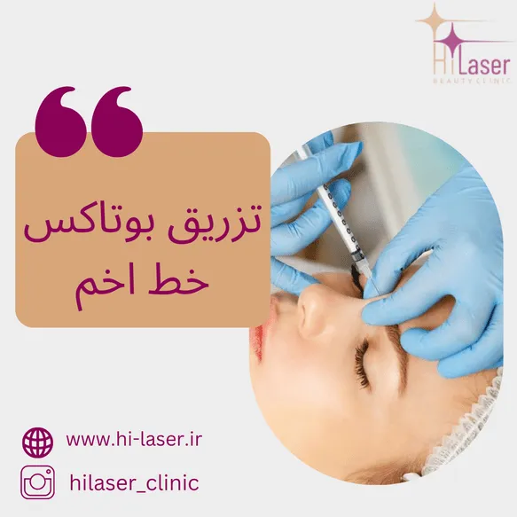 بوتاکس خط اخم