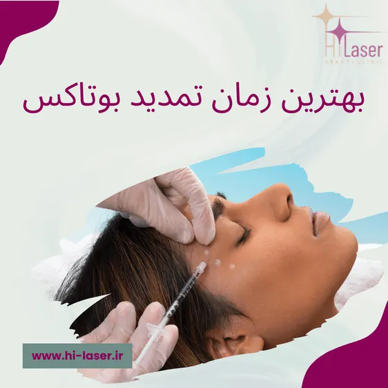 بهترین زمان تمدید بوتاکس