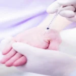 تزریق بوتاکس کف دست