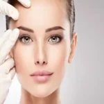 لیفت شقیقه با بوتاکس