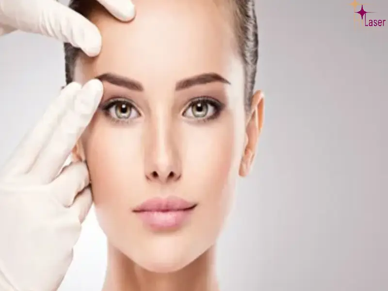 لیفت شقیقه با بوتاکس