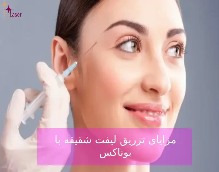 مزایای تزریق لیفت شقیقه با بوتاکس