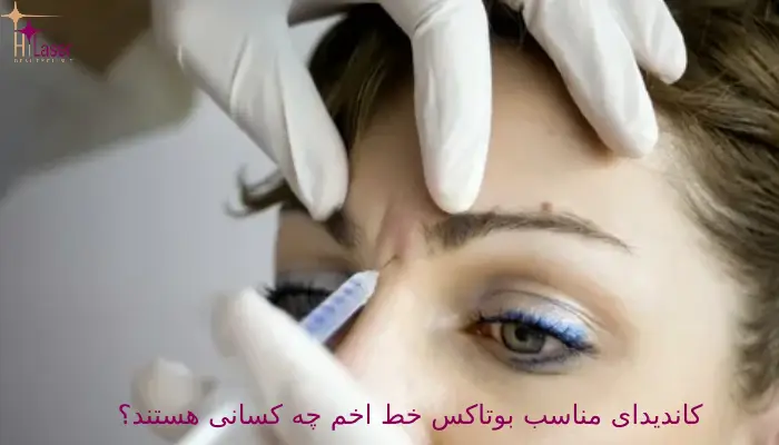 کاندیدای مناسب بوتاکس خط اخم